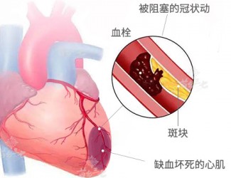 心臟病該怎么辦，且看臨床治療醫(yī)案一則